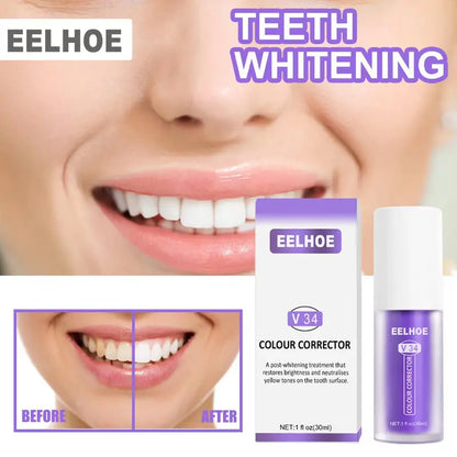 V34 Teeth Whitening Toothpaste Kit for Oral Hygiene