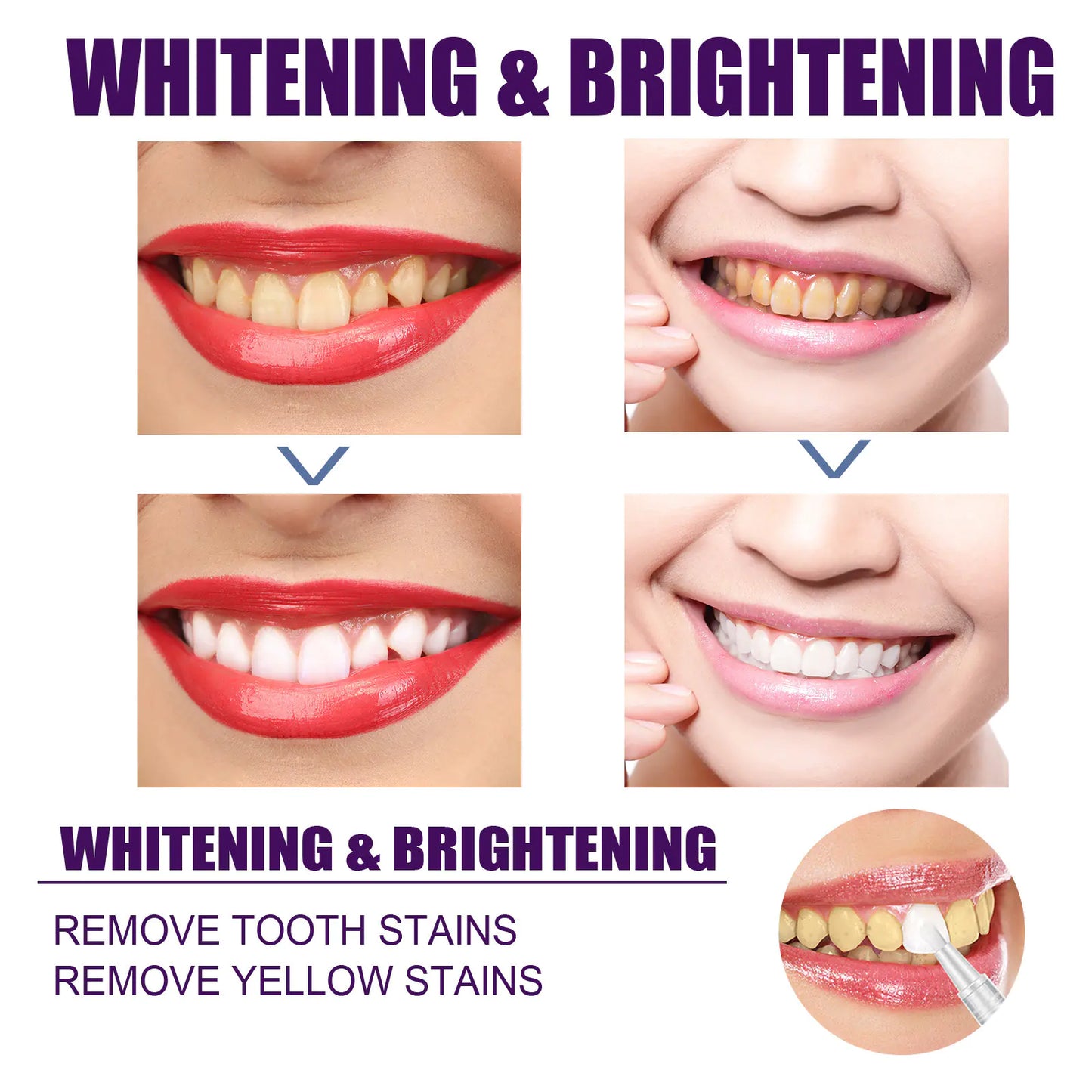 EELHOE V34 Purple Teeth Whitening Pen for Stain Removal